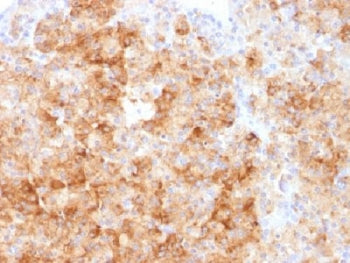 Chromogranin A Antibody