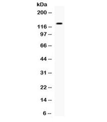 Western blot testing of human 22RV1 cell lysate with EGF antibody. Expected molecular weight: 134-16