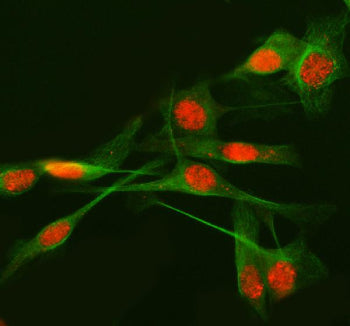 Immunofluorescent staining of METTL17 using anti-METTL17 antibody (red) and anti-Beta Tubulin antibo