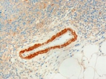 IHC testing of FFPE human lymph node with USP20 antibody at 3ug/ml. Microwaved antigen retrieval wit