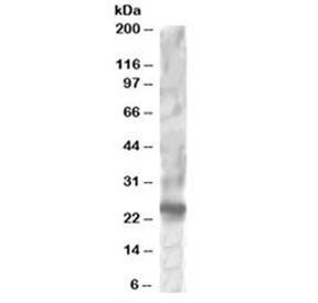 Western blot testing of HepG2 lysate with RGS1 antibody at 1ug/ml. Predicted molecular weight: ~24 k