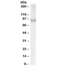 Western blot testing of human MOLT4 lysate with ACAP2 antibody at 1ug/ml. Predicted molecular weight