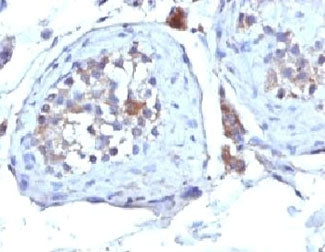 SHBG Antibody (Sex Hormone Binding Globulin)