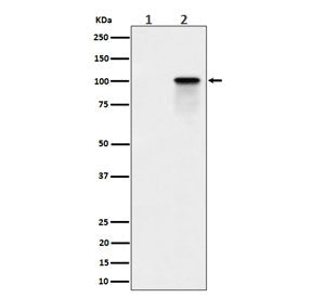 Western blot testing of lysate from human K562 cells, untreated (1) and Calyculin A treated (2), wit