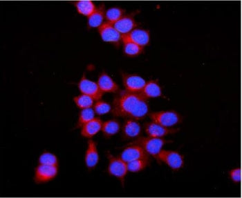 RAB7A Antibody
