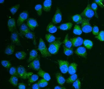 CA13 Antibody / Carbonic Anhydrase XIII