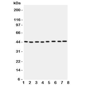 Western blot testing of PGK1 antbody; Lane 1: rat liver; 2: (r) brain; 3: (r) lung; and human sample