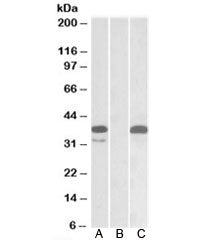 PIM2 Antibody
