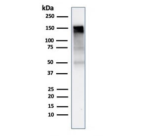 Western blot testing of human A431 cell lysate with EGFR antibody (clone rGFR/1667). Expected molecu