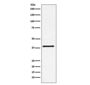 Western blot testing of mouse NIH3T3 cell lysate with CD152 antibody. Predicted molecular weight ~25