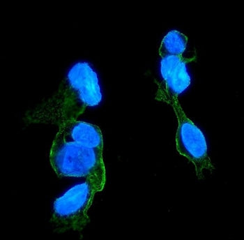 Immunofluorescent staining of FFPE human HepG2 cells with CCR2 antibody (green) and DAPI nuclear sta