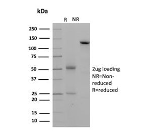 SDS-PAGE analysis of purified, BSA-free Desmoglein 2 antibody (clone 8E5) as confirmation of integri