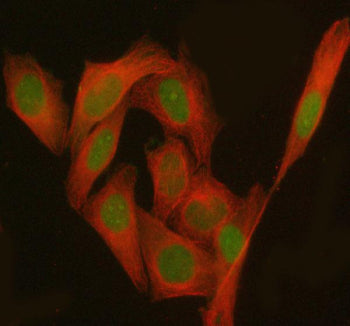 Immunofluorescent staining of PHF17/JADE1 using anti-JADE1 antibody (green) and anti-Beta Tubulin an