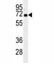 HSPA1A Antibody, 0.08ml