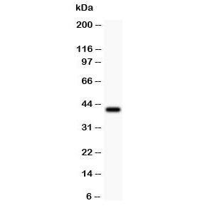 Western blot testing of Collagen IV antibody and recombinant human partial protein 0.5ng.