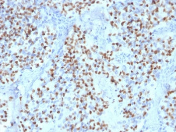 IHC testing of FFPE human lymph node with OCT-2 antibody (clone OCT2/2136). HIER: boil tissue sectio