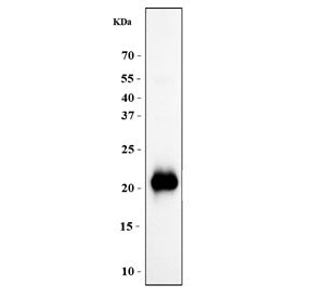 Western blot testing of human placental tissue with GH1 antibody. Predicted molecular weight: 22-25 