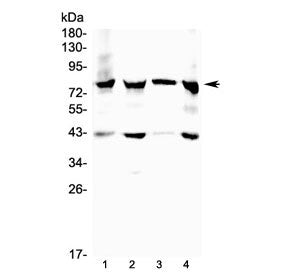 Western blot testing of 17-beta-Hydroxysteroid dehydrogenase 4 antibody and Lane 1: mouse heart; 2: 