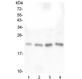 Western blot testing of human 1) placenta, 2) U-937, 3) K562 and 4) ThP-1 lysate with TAF12 antibody
