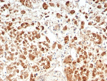 IHC staining of FFPE human adrenal gland tissue with IL-18R alpha antibody (clone IL18R1/7593). HIER