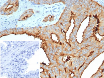 IHC staining of FFPE human prostate tissue with Transmembrane protease serine 2 antibody (clone TMPR