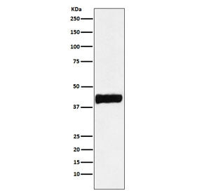 CKB Antibody / Creatine kinase B