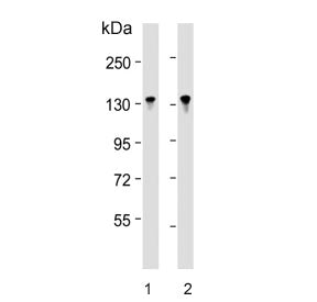 Western blot testing of human 1) Jurkat and 2) MOLT4 cell lysate with BCL11B antibody. Predicted mol