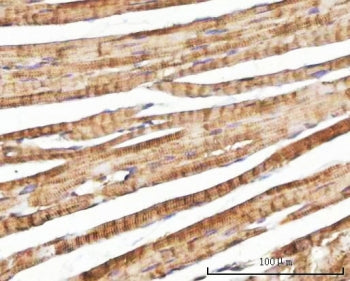 IHC staining of FFPE mouse heart tissue with Nebulette antibody. HIER: boil tissue sections in pH8 E