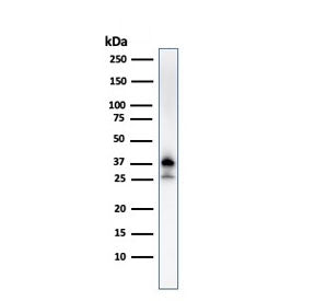 Western blot testing of human K562 cell lysate with Nucleophosmin antibody (clone NPM1/3287). Expect