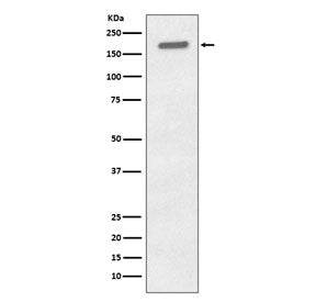 Western blot testing of lysate from human A431 cells treated with EGF with phospho-EGFR antibody. Ex