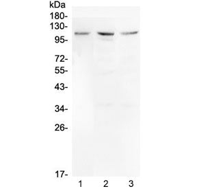 Western blot testing of human 1) U-87 MG, 2) HepG2 and 3) A375 cell lysate with Mib1 antibody at 0.5