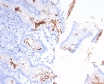 Helicobacter pylori Antibody (Catalase)