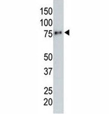 HA Antibody