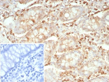 STMN1 Antibody / Stathmin 1