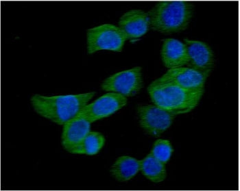 Immunofluorescent staining of FFPE human A431 cells with RAC1 antibody (green) and DAPI nuclear stai