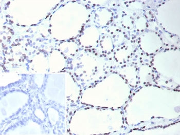 IHC staining of FFPE human thyroid tissue with Thyroid transcription factor 1 antibody (clone NX2.1/