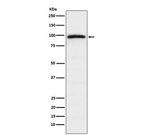 Western blot testing of human HeLa cell lysate with Epac1 antibody. Predicted molecular weight ~104 
