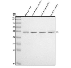 Western blot analysis of Integrin-linked kinase protein using Integrin-linked kinase antibody and 1)