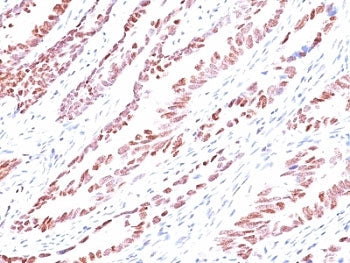 p57 Antibody / p57Kip2