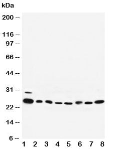 Western blot testing of Rab5 antibody and Lane 1: rat brain; 2: rat ovary; 3: human placenta; 4: HeL