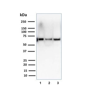 CSTF2T Antibody / Cleavage stimulation factor subunit 2 tau variant