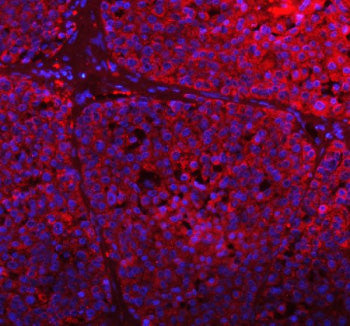 Immunofluorescent staining of GCLC using anti-GCLC antibody (red). GCLC was detected in a paraffin-e