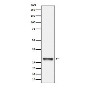 Western blot testing of human K562 cell lysate with PNMT antibody. Predicted molecular weight ~31 kD