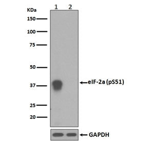 Western blot testing of lysate from human HeLa cells 1) treated with Calyculin A and 2) untreated, w
