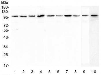Plasminogen Antibody / PLG