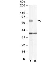 ACOX2 Antibody