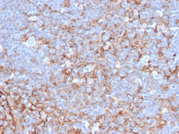 IHC staining of FFPE human tonsil tissue with CD21 antibody (clone CR2/6683). HIER: boil tissue sect