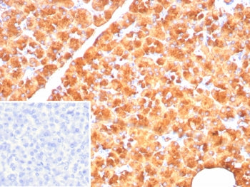 PNLIP Antibody / Pancreatic lipase
