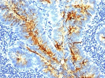 TAG-72 Antibody