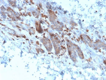 IL1 alpha Antibody / IL1A